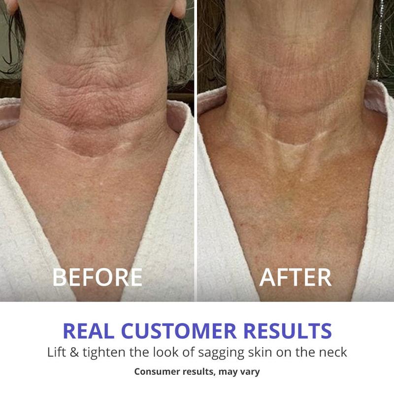 Tighten & Lift Firming Neck Cream (70% OFF Today only)