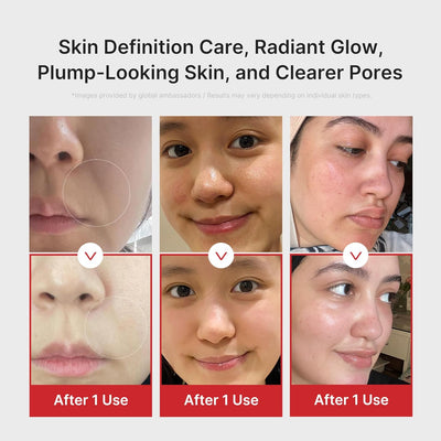 medicube AGE-R Booster-H |  K-beauty Glow Booster Device
