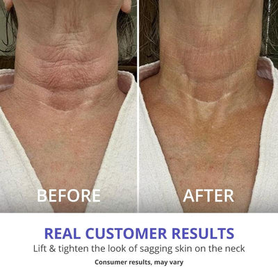 Tighten & Lift Firming Neck Cream (70% OFF Today only)