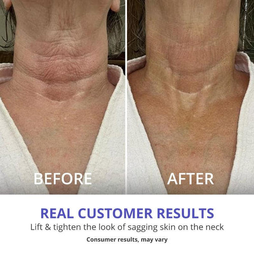 Tighten & Lift Firming Neck Cream (70% OFF Today only)