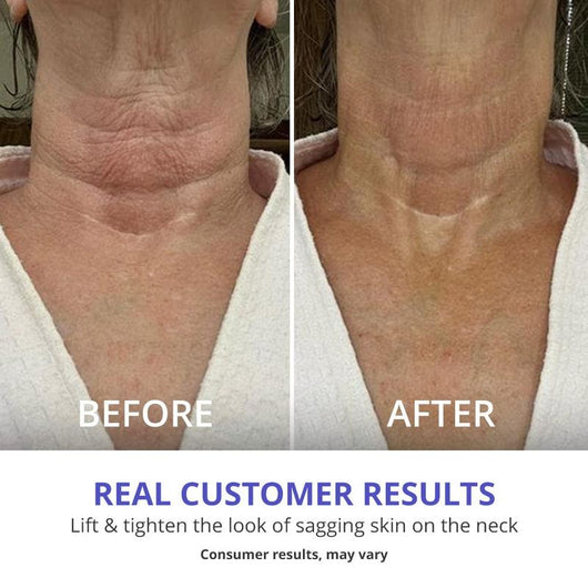 Tighten & Lift Firming Neck Cream (70% OFF Today only)